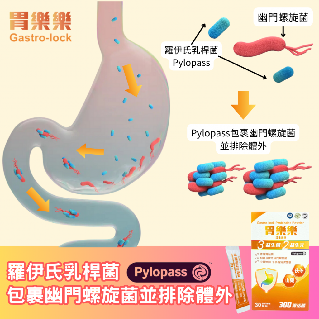 幽門螺旋菌的剋星 | 羅伊氏乳桿菌Pylopass™ | 幽門螺旋菌治療